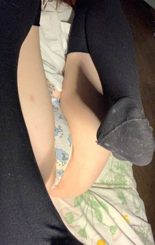 [Image: I-17135f8d500b8a6b3.md.jpg]